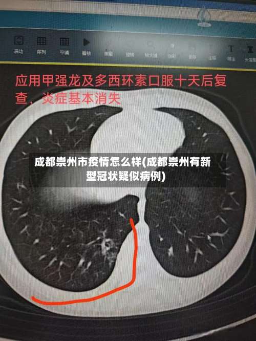 成都崇州市疫情怎么样(成都崇州有新型冠状疑似病例)