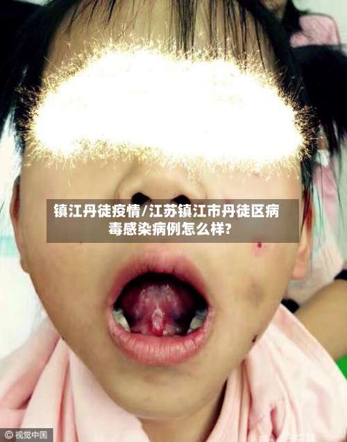 镇江丹徒疫情/江苏镇江市丹徒区病毒感染病例怎么样?