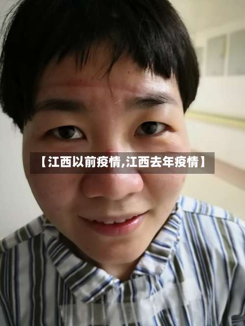 【江西以前疫情,江西去年疫情】-第3张图片