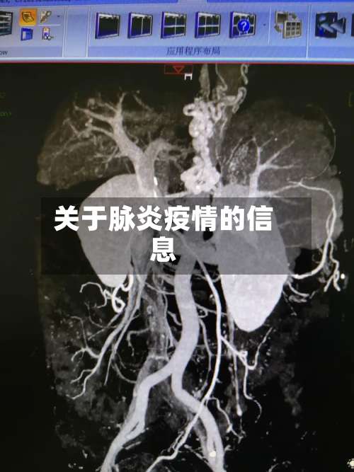 关于脉炎疫情的信息-第2张图片