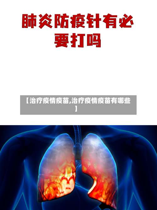 【治疗疫情疫苗,治疗疫情疫苗有哪些】-第2张图片