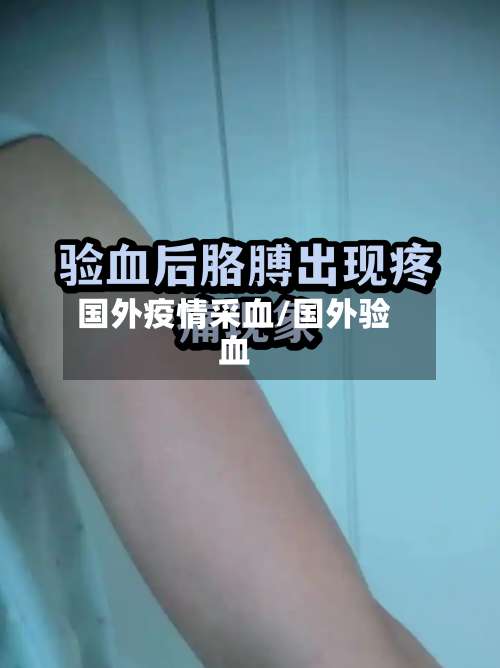 国外疫情采血/国外验血-第2张图片